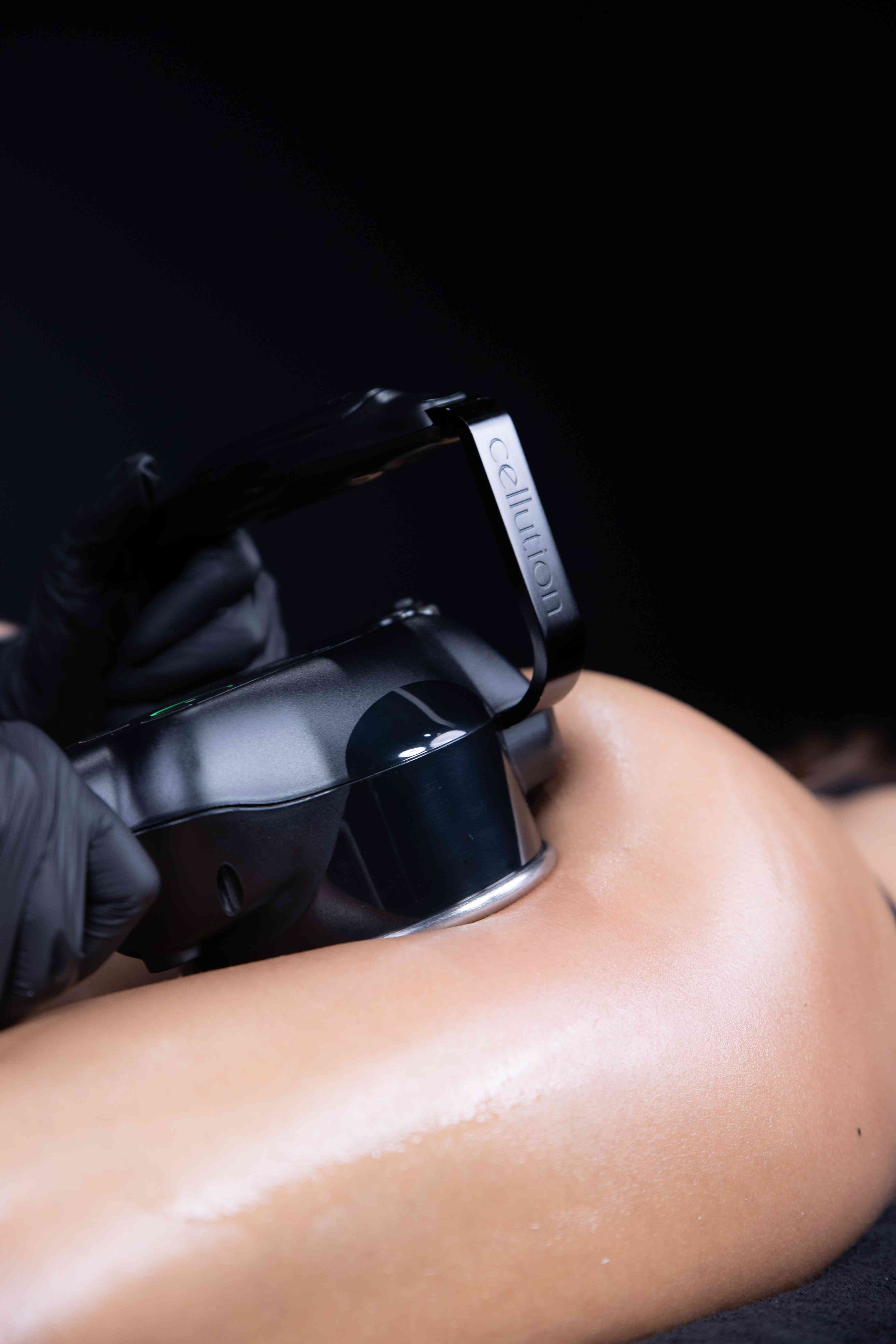 Close-up van de Cellution-applicator met mechanische massage op ingeoliede huid